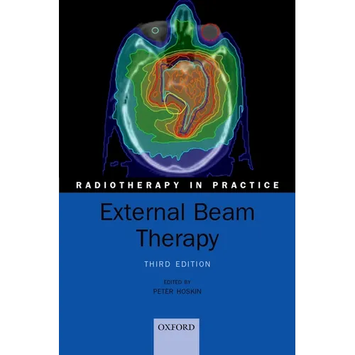 External Beam Therapy - Paperback