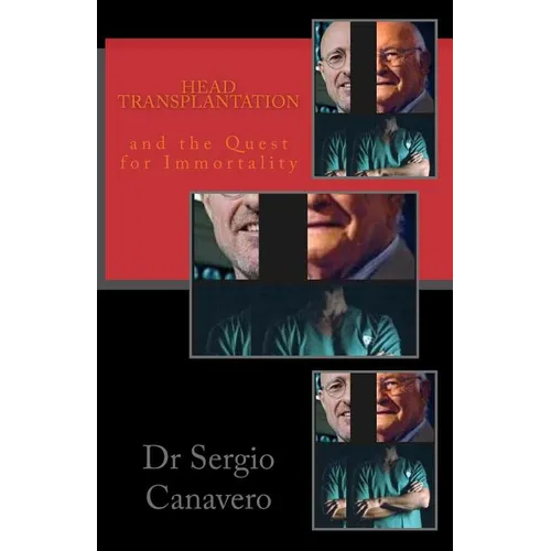 Head Transplantation: and the QUEST for IMMORTALITY - Paperback