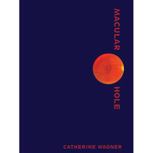 Macular Hole - Paperback