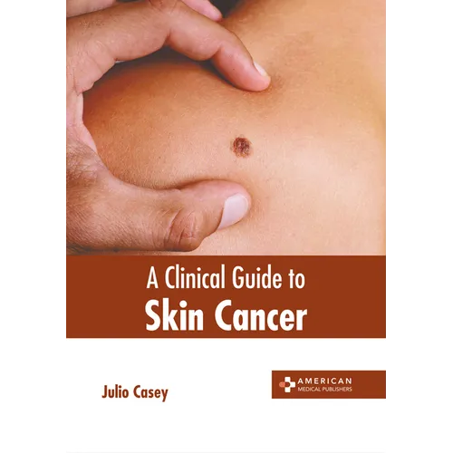 A Clinical Guide to Skin Cancer - Hardcover