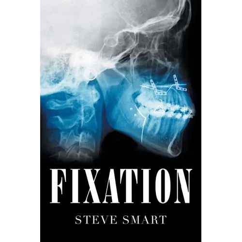 Fixation