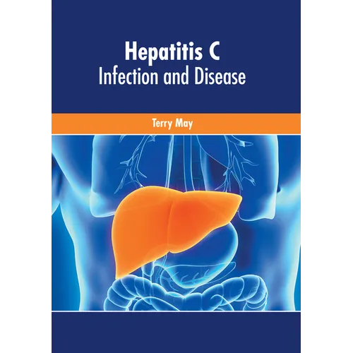 Hepatitis C: Infection and Disease - Hardcover