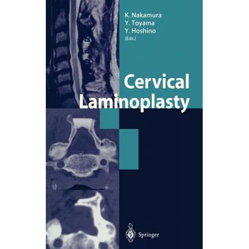 Cervical Laminoplasty - Hardcover
