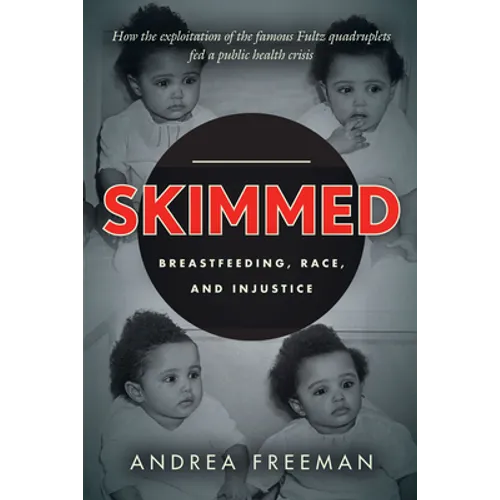 Skimmed: Breastfeeding, Race, and Injustice - Hardcover